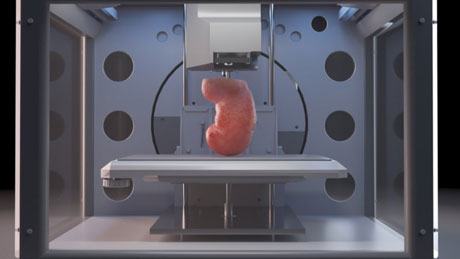 3D printing a kidney